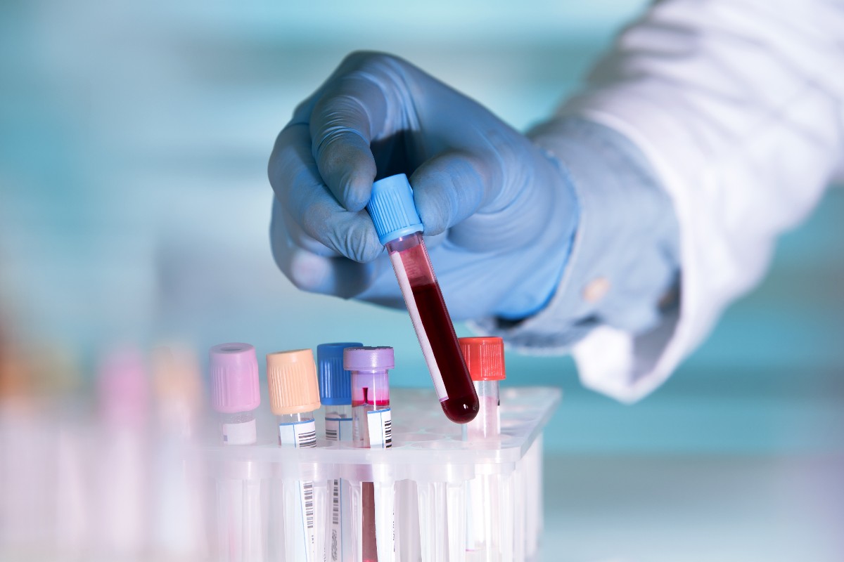 A blood test in a lab