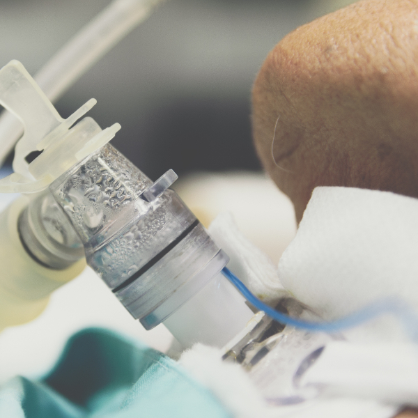 Patient with tracheostomy