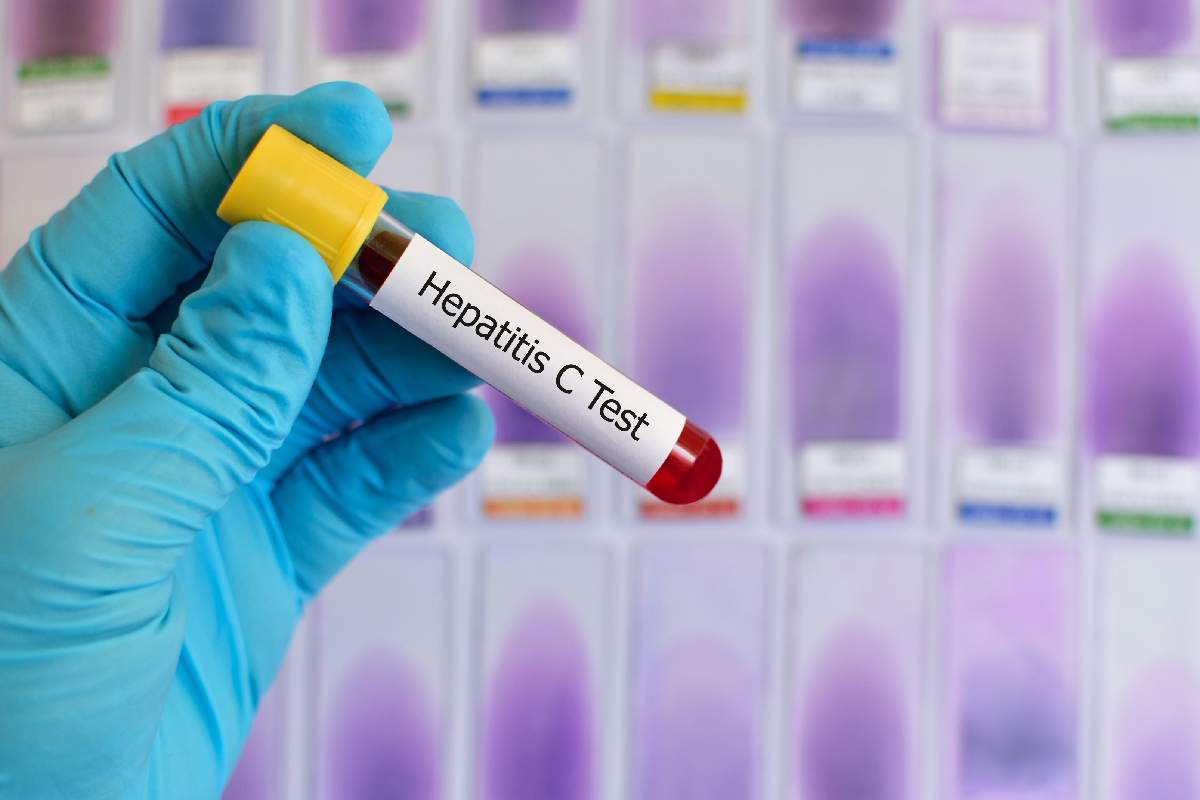 A test-tube labelled 'Hepatitis C Test' being held by a healthcare worker.