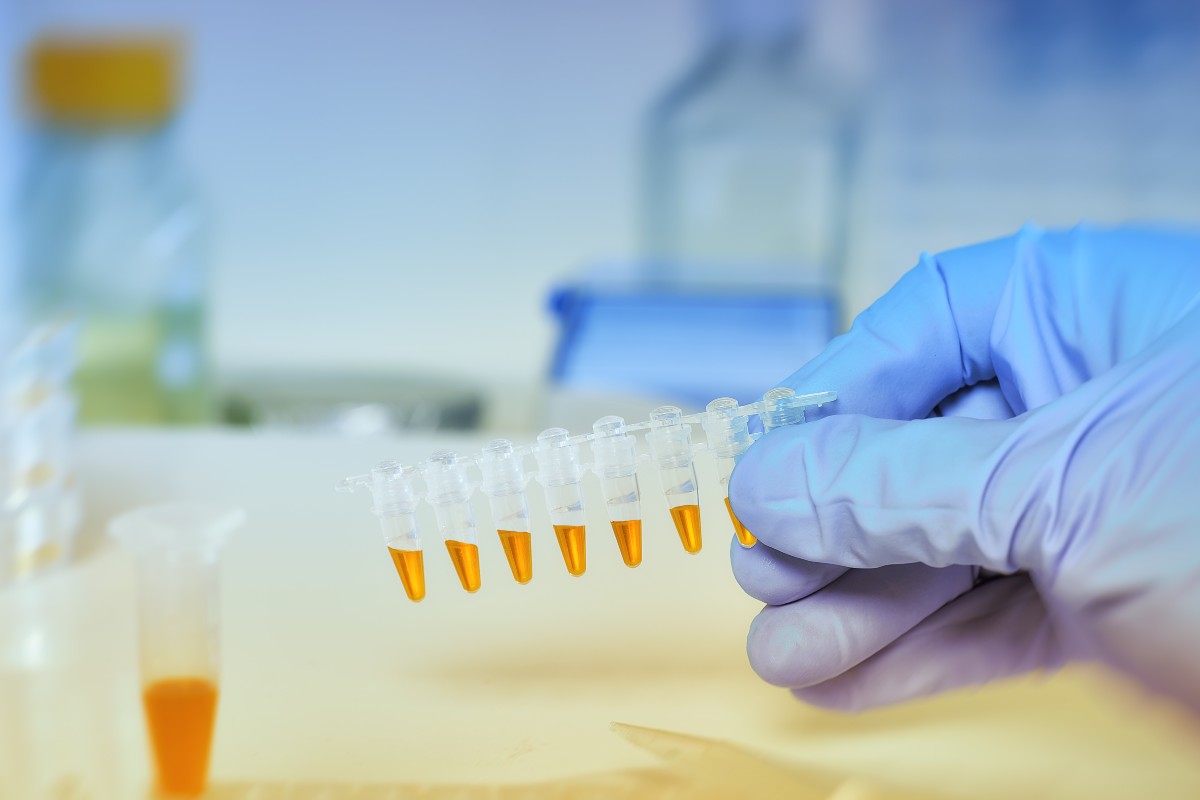 Hand in blue glove holding samples for DNA amplification with orange reaction mictures