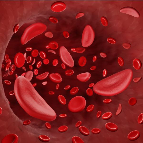 Sickle Cell